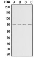 ADAR2 / ADARB1 Antibody (Internal)