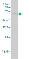 IHC-plus™ PHGDH Antibody (clone 4A3-1D6)