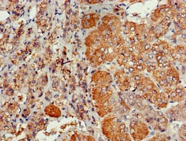 CDC6 Antibody