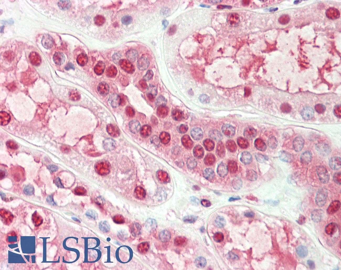 IHC-plus™ HSP90AB1 / HSP90 Alpha B1 Antibody (aa211-260)