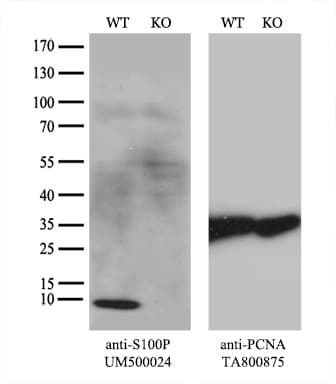 Monoclonal Mouse anti-Human S100P Antibody (clone UMAB24, IHC, IF, WB)