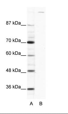 Polyclonal Rabbit anti-Human GLI / GLI1 Antibody (aa1007-1056, WB)