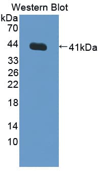 NR1H3 / LXR Alpha Antibody (aa95-434)