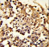 HSPH1 / HSP105 Antibody (aa549-579)