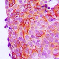 Polyclonal Rabbit anti-Human CDH17 / Cadherin 17 Antibody (Internal, IHC, WB)