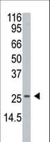 APH1A / APH-1 Antibody (aa77-109)