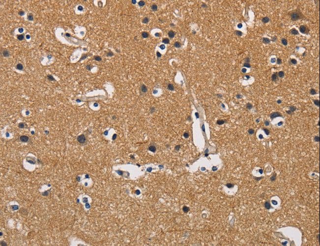 CBY1 / PGEA1 Antibody