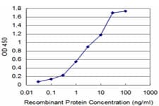 AKR1A1 Antibody (clone 1A11-2A4)