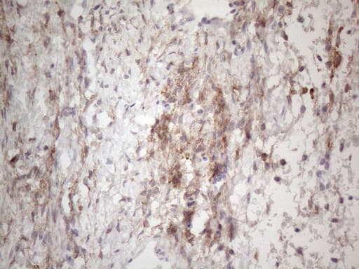 PDGFRA / PDGFR Alpha Antibody (aa789-1089, clone OTI1C10)