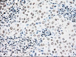 NRBP1 / NRBP Antibody (clone OTI5C3)