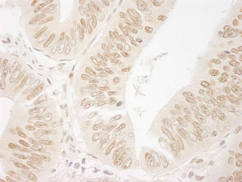 FAC1 / BPTF Antibody (aa1350-1400)