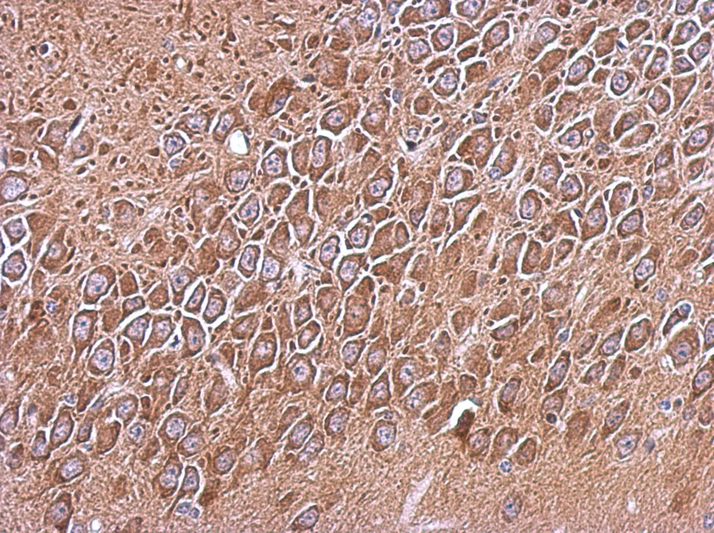 RP105 / CD180 Antibody (Internal)
