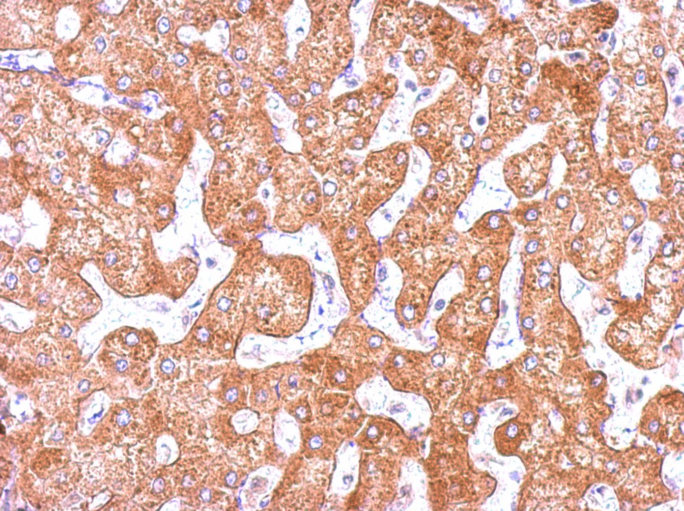 Polyclonal Rabbit anti-Human TUBGCP2 / GCP2 Antibody (aa1-226, IHC, WB)