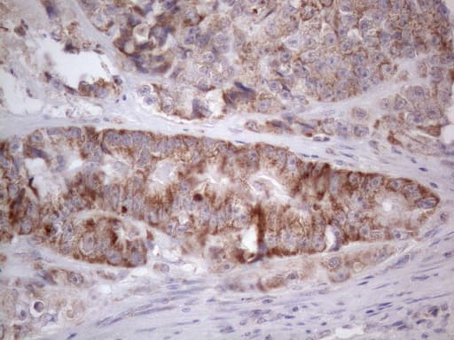 Monoclonal Mouse anti-Human RORB / ROR Beta Antibody (clone OTI1G1, aa1-260, IHC, WB)
