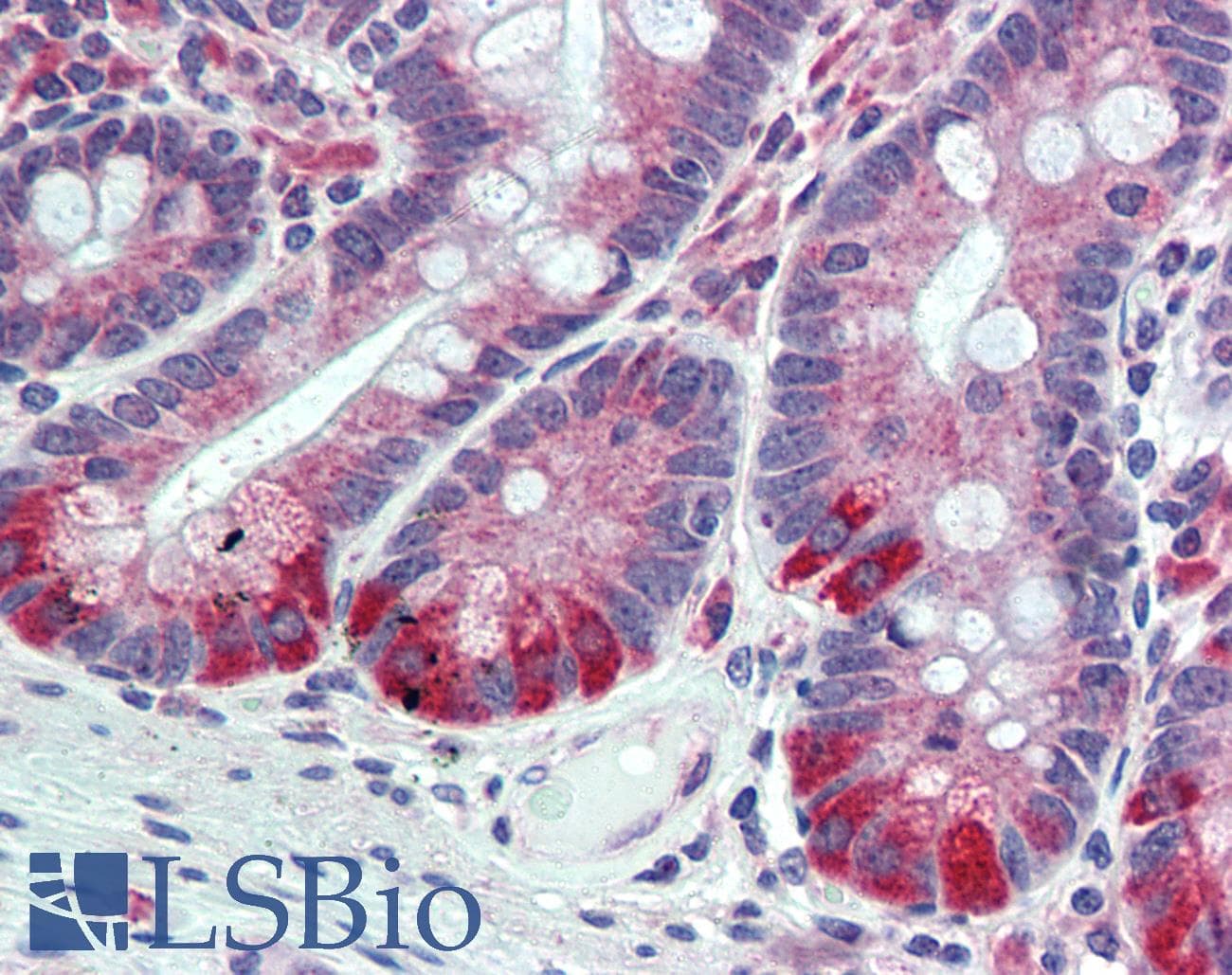 IHC-plus™ Polyclonal Rabbit anti-Human ESYT1 Antibody (Internal, IHC)