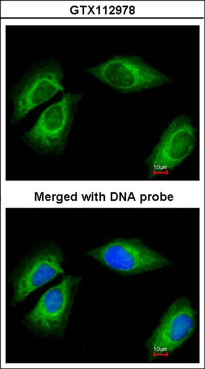 PathPlus™ Polyclonal Rabbit anti-Human KRT18 / CK18 / Cytokeratin 18 Antibody (IHC, IF, WB)