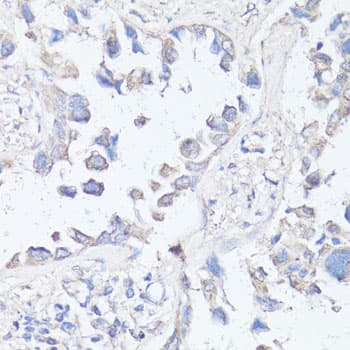 MTOR Antibody