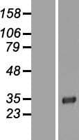 LRRC3B Protein (Over-Expression Lysate Myc-DDK (Flag))