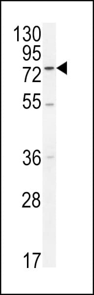 ENTHD1 Antibody (aa169-198)