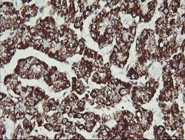 MAP2K2 / MKK2 / MEK2 Antibody (clone OTI1A2)