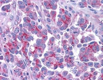 Polyclonal Rabbit anti-Human DIABLO / SMAC Antibody (aa225-239, IHC, WB)