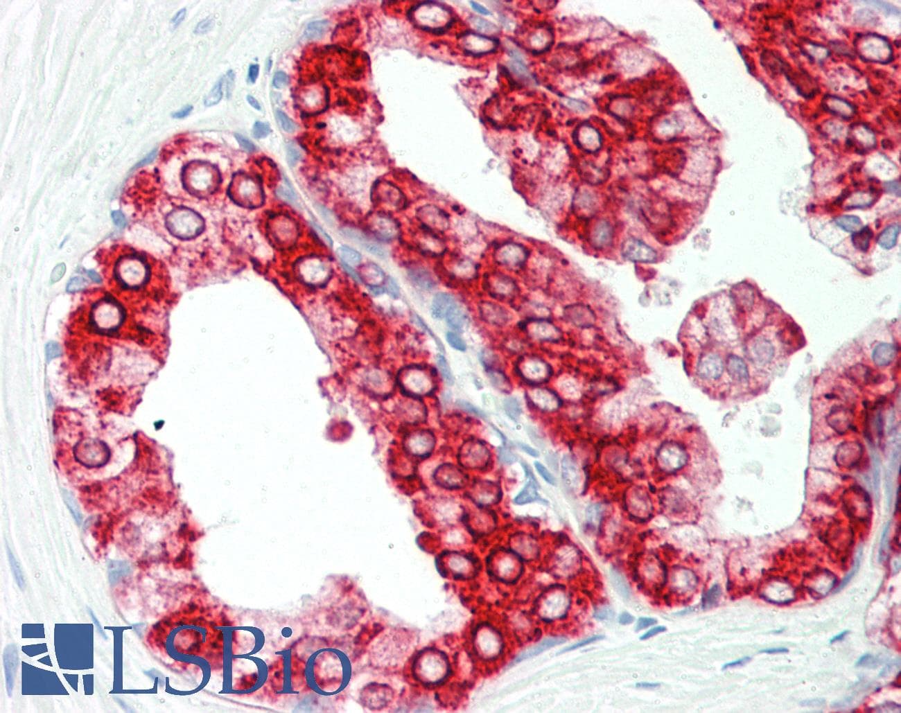 PathPlus™ Monoclonal Mouse anti-Human AGR2 Antibody (aa21-175, IHC, WB)