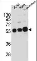 CAMK1G / CaMKI gamma Antibody (aa211-241)