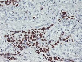 TP53 / p53 Antibody (clone OTI1D11, Carrier-free)