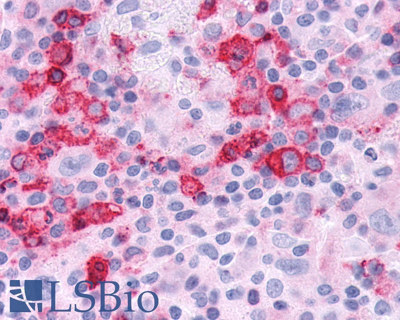 PathPlus™ FZD4 / Frizzled 4 Antibody (C-Terminus)