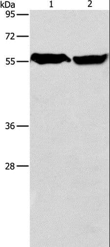 Polyclonal Rabbit anti-Human ARHGEF9 / Collybistin Antibody (IHC, WB)