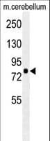 RPS6KA1 / RSK1 Antibody
