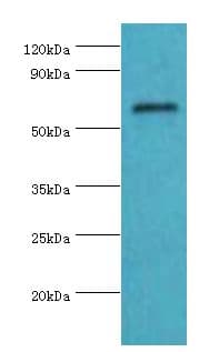 COL10A1 / Collagen X Antibody (aa521-680)
