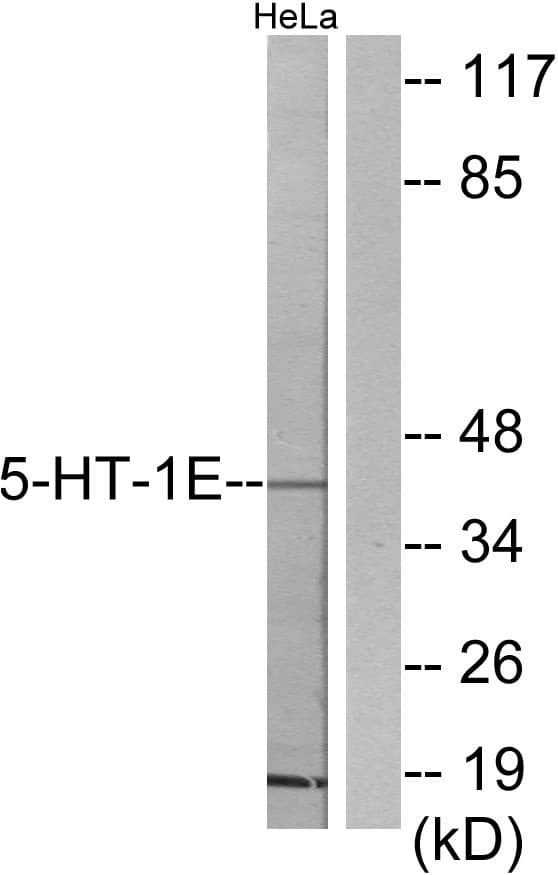 Polyclonal Rabbit anti-Human HTR1E / 5-HT1E Receptor Antibody (aa101-150, WB)