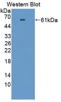 Polyclonal Rabbit anti-Mouse PRCP Antibody (PE, aa169-443, WB)