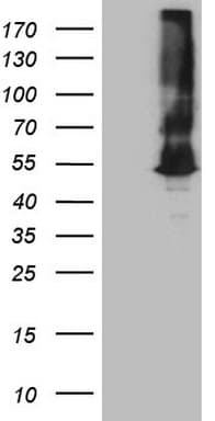 ASS1 / ASS Antibody (C-Terminus, clone OTI8A3)