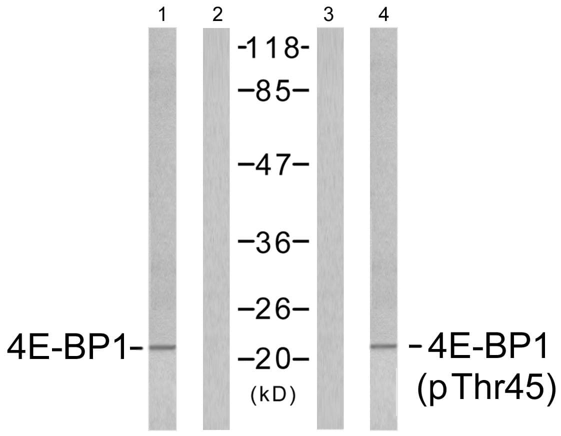EIF4EBP1 / 4EBP1 Antibody (p45)