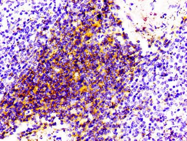 Recombinant Monoclonal Rabbit anti-Human CD4 Antibody (IHC, WB)