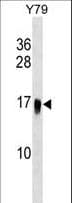 UBE2G1 Antibody (aa127-155)