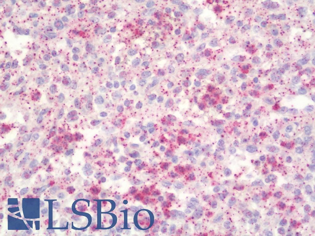 IHC-plus™ LCN2 / Lipocalin 2 / NGAL Antibody