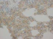 CYCS / Cytochrome c Antibody (aa91-105)