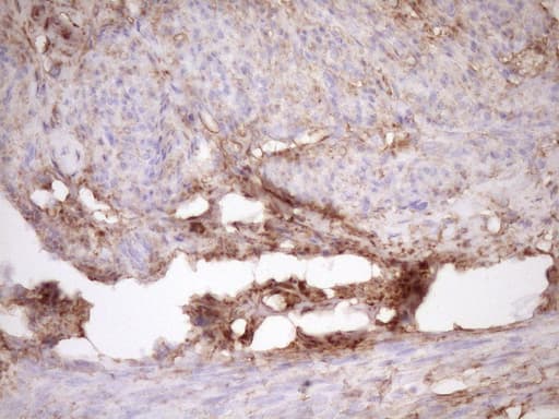 Monoclonal Mouse anti-Human FSCN1 / Fascin Antibody (clone OTI3B4, IHC, WB)