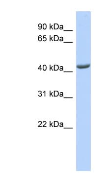 ST3GAL4 / ST3Gal IV Antibody (aa251-300)