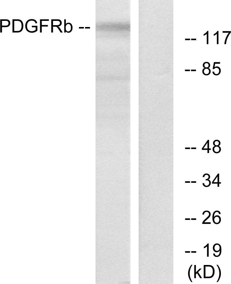 Polyclonal Rabbit anti-Human PDGFRB / PDGFR Beta Antibody (p752, IHC, IF, WB)