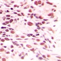LYAR Antibody (Internal)