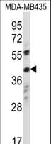 Polyclonal Rabbit anti-Human OR8K1 Antibody (aa286-314, WB)
