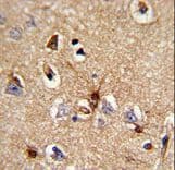 PRDX6 / Peroxiredoxin 6 Antibody (aa197-224)