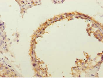 Polyclonal Rabbit anti-Human FLVCR2 Antibody (IHC, WB)