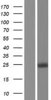 Thymidylate Kinase Protein (Over-Expression Lysate Myc-DDK (Flag))