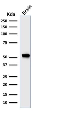PathPlus™ GFAP Antibody (clone rASTRO/789)