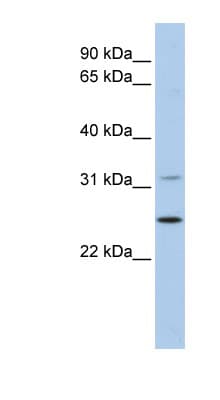 DHRS1 Antibody (aa36-85)